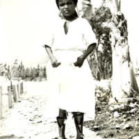 SLM FH1018-6331 - Ung flicka med benskenor, Etiopien 1964
