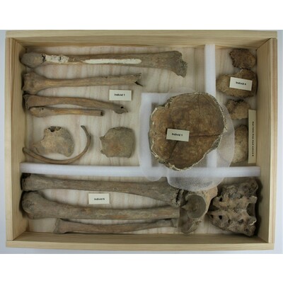 SLM 18203 Låda 1/5 - Skelettdelar från människa, tre individer