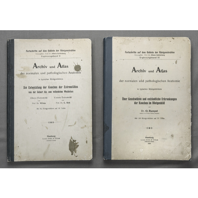 SLM 39195 1-2 - Två läkarböcker med röntgenbilder 1902 och 1908, från Mälarsjukhuset i Eskilstuna