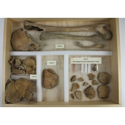 SLM 18203 Låda 2/5 - Skelettdelar från människa, tre individer